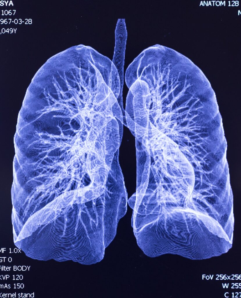 Lungs