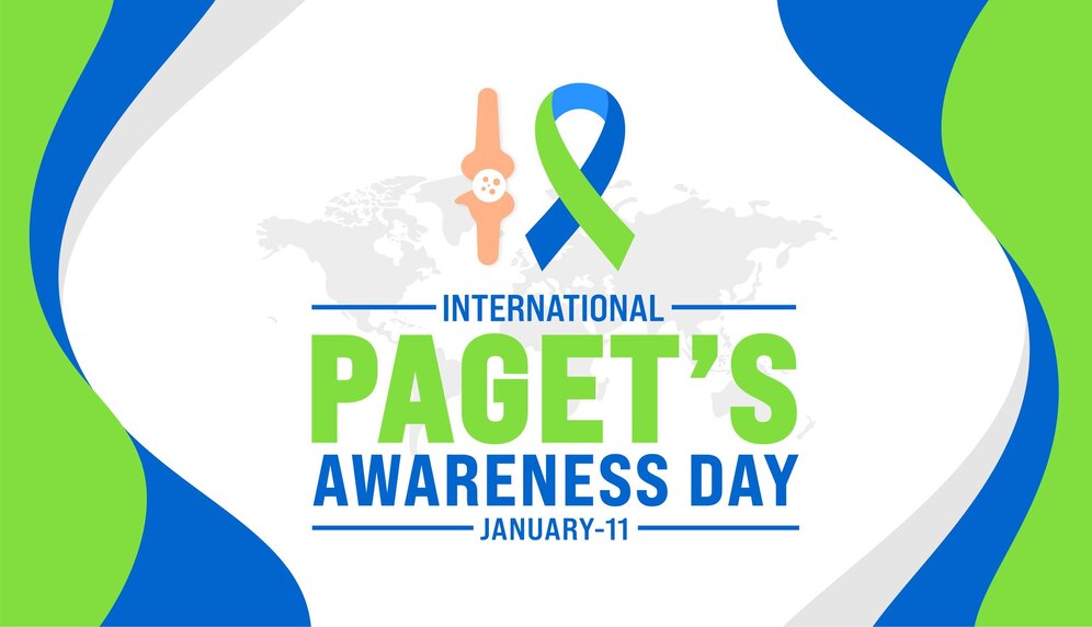 Paget’s Awareness Day  - Research and Advancements in Paget’s Disease