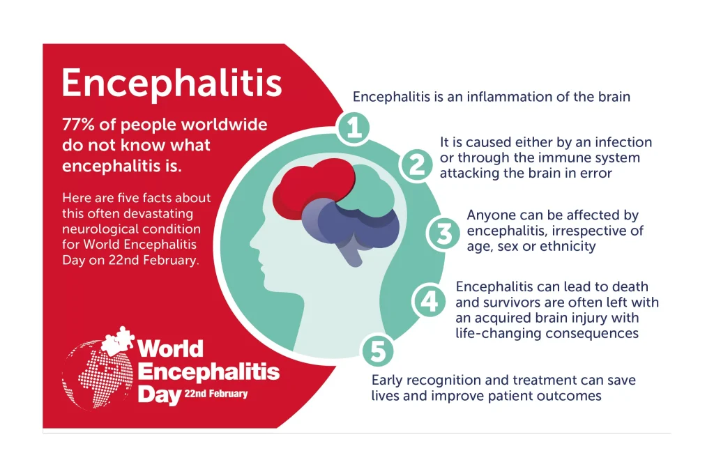 encephalitis five facts